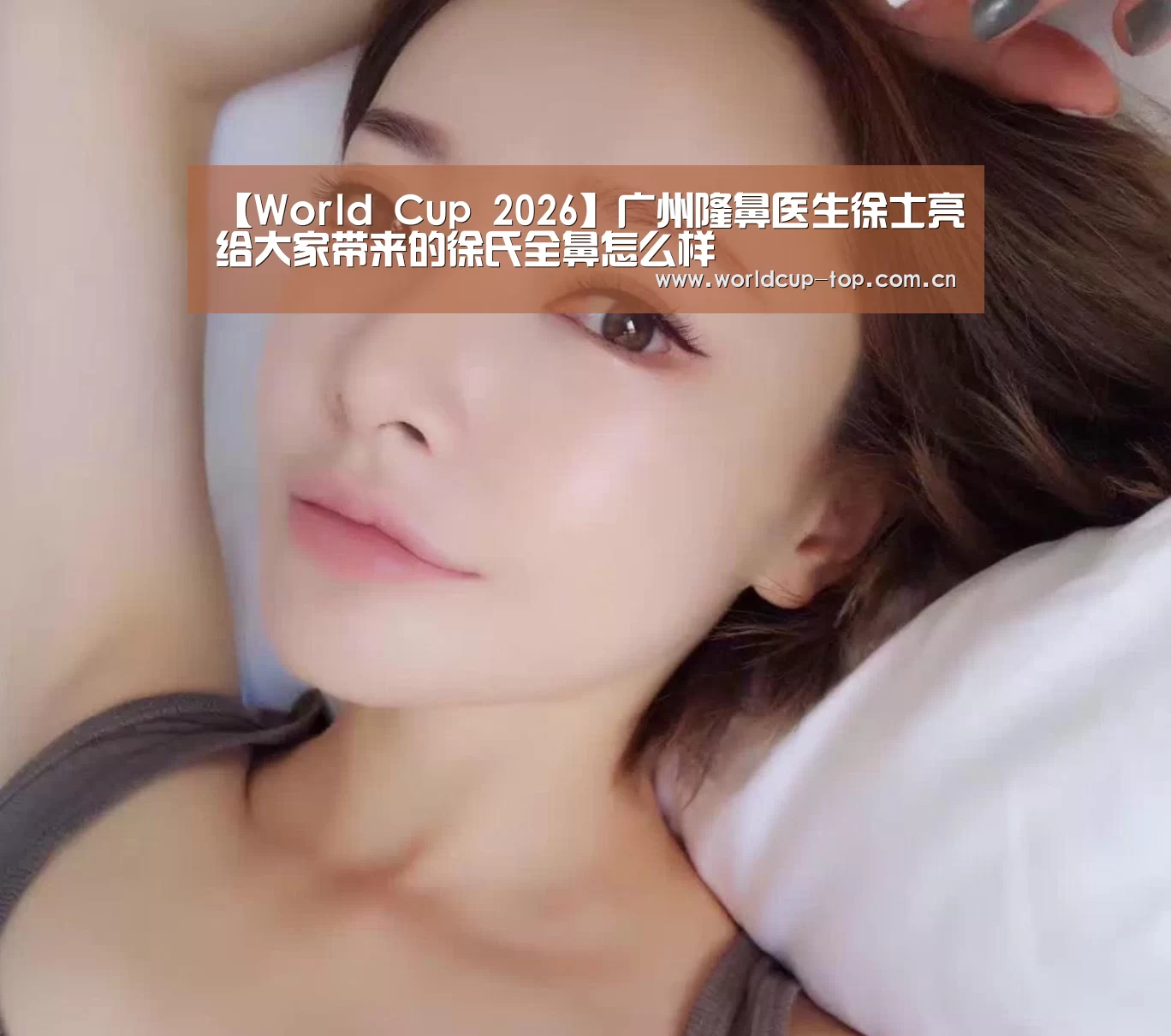 【World Cup 2026】广州隆鼻医生徐士亮给大家带来的徐氏全鼻怎么样(图1) World Cup 2026